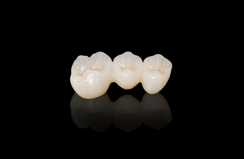 FCZ(Full Contour Zirconia）